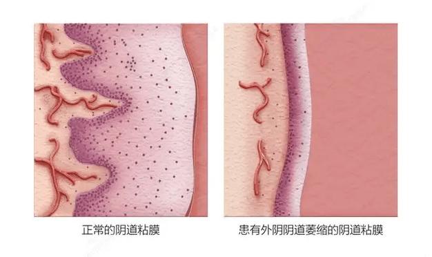 苹果手机怎么不共享照片