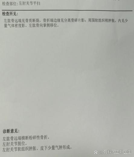医院拍的片子网上怎么查