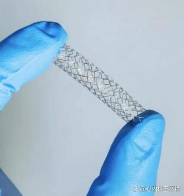 心脏支架一次可以放几个缩略图