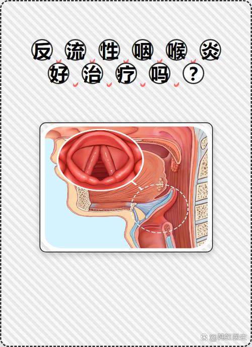 声音嘶哑的治疗方法
