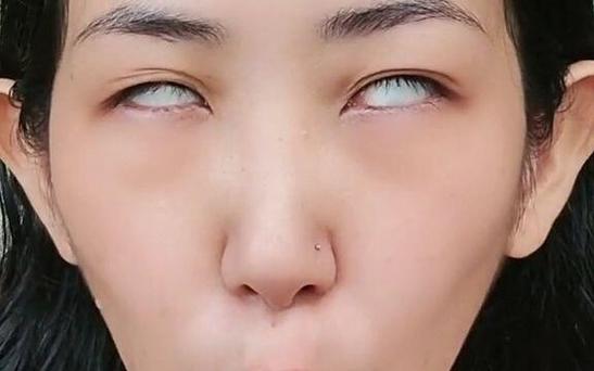 女人翻白眼是什么情况