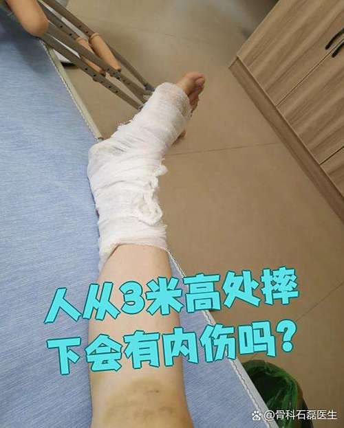 三米高摔下来当时没事