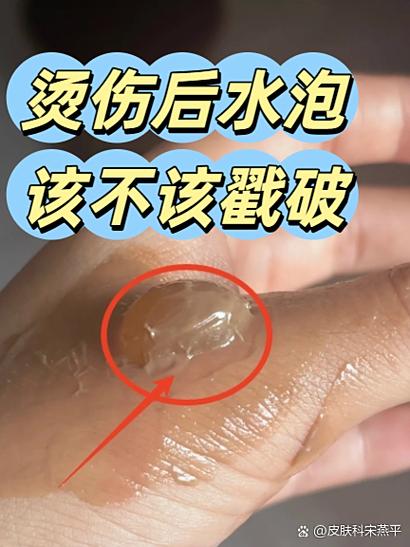 被圆珠笔戳破皮肤脸部图标