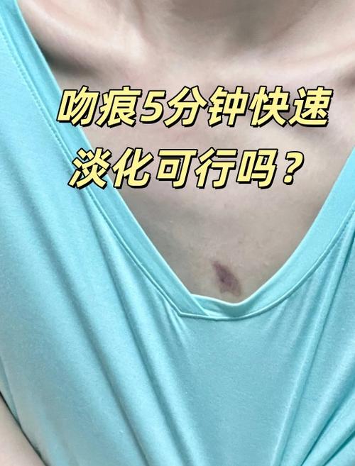 嘴吸的红印怎么5分钟消除截图