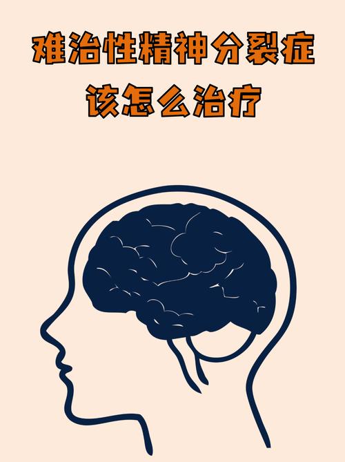 催眠调控模式程明新征