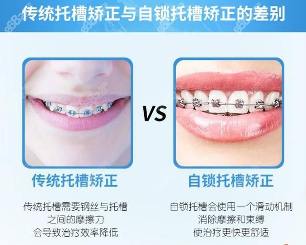 正畸和矫正有什么区别缩略图