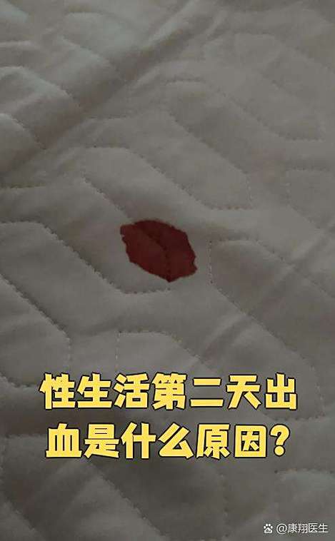 经期前一天同房出鲜血图标
