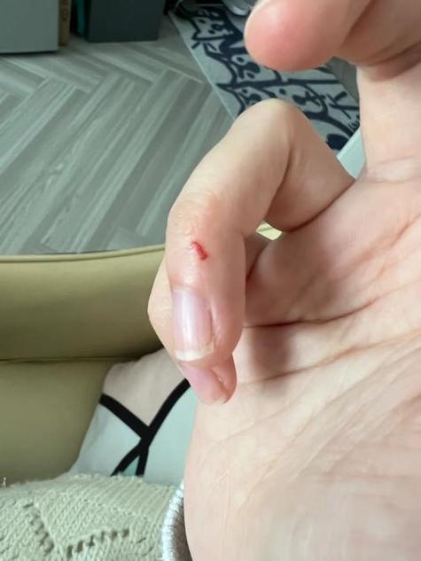 被咬伤的仓鼠怎么处理截图
