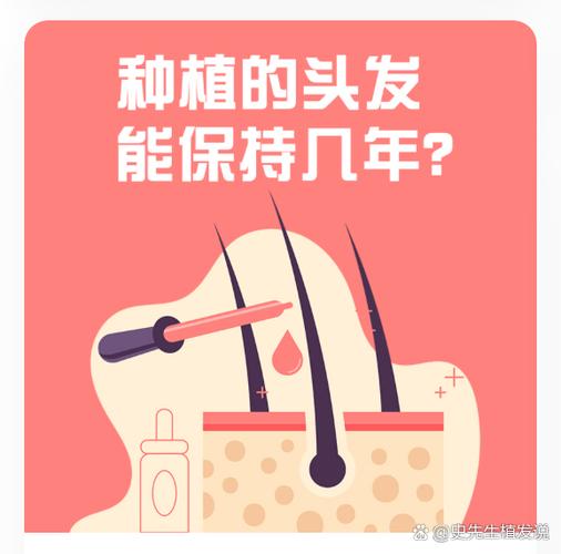 植发还会掉吗维持多久