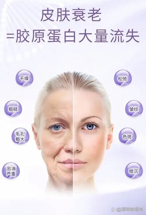 吃什么能补充脸上的胶原蛋白