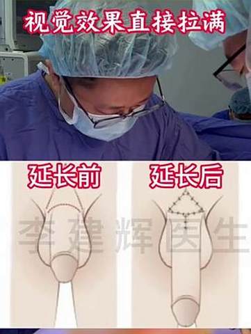 增大增长增粗速效短小变大变长