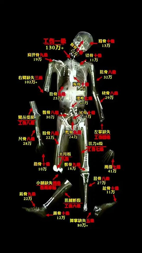 被车撞骨折了怎么赔偿标准截图