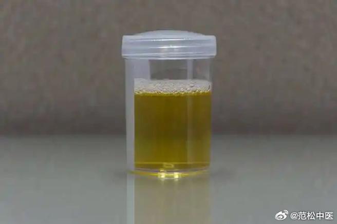 排尿性状是什么