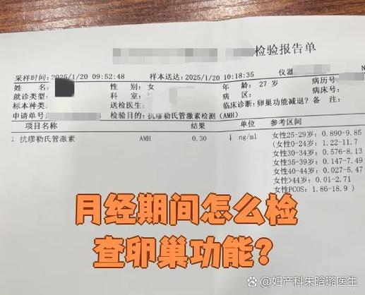 查卵巢功能月经第几天查准确