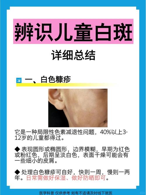 脸上长白色糠疹图片