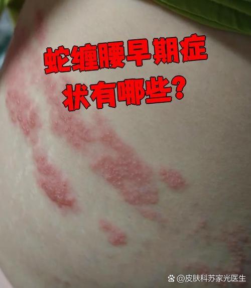 蛇盘苍长肚子上好了怎么还痛截图