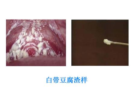 引导白色豆腐渣