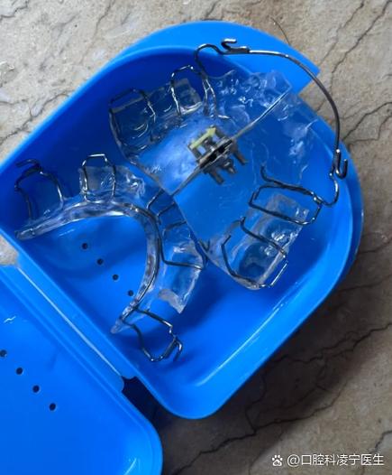 自制牙齿矫正器
