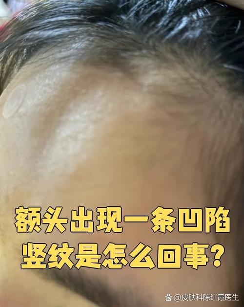 男人额头有竖纹好不好