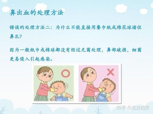 如何止住流鼻血