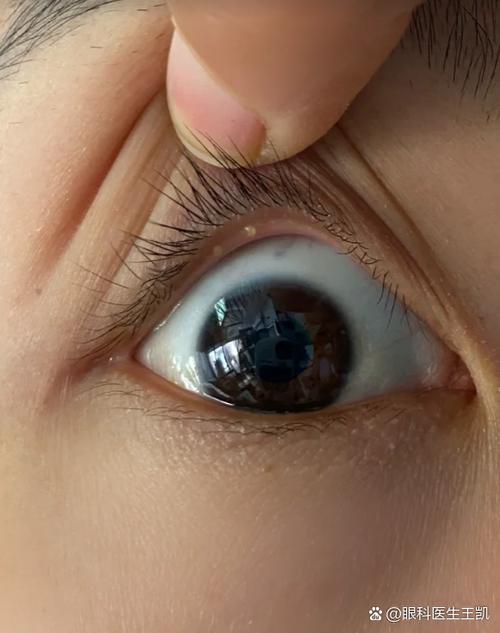 常看白色对眼睛有好处吗
