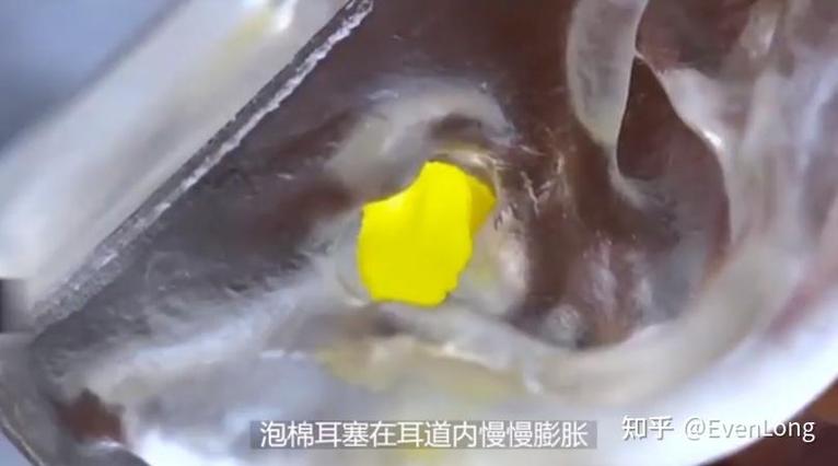 为什么耳塞老是掉出来