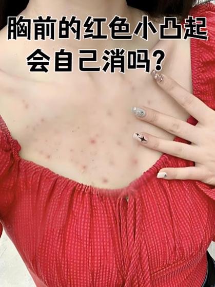 皮肤增生凸起怎么修复
