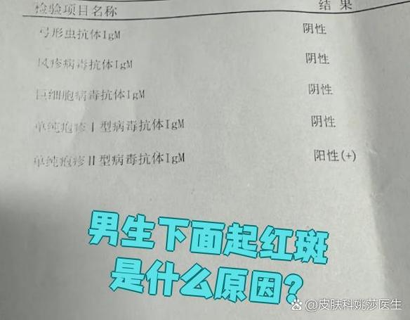 男性阴部红斑是什么病