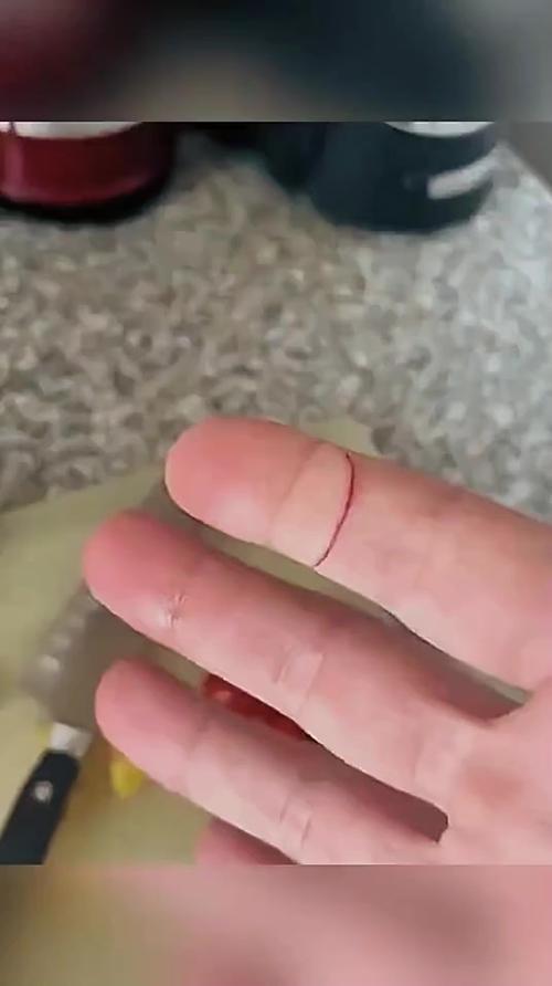 不小心用水果刀划伤了