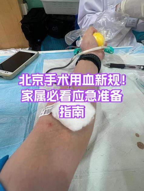 医院用血规定