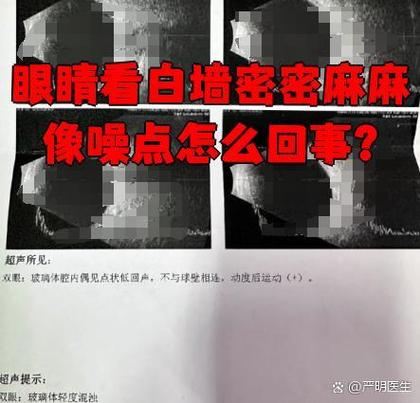 白墙壁上有密密麻麻的黑点
