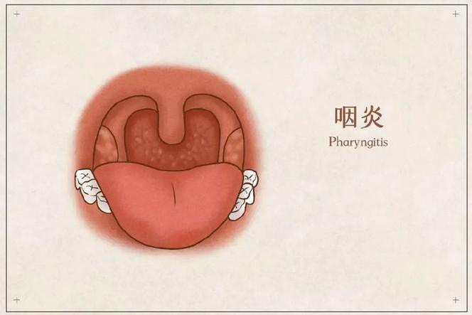 嗓子经常失声