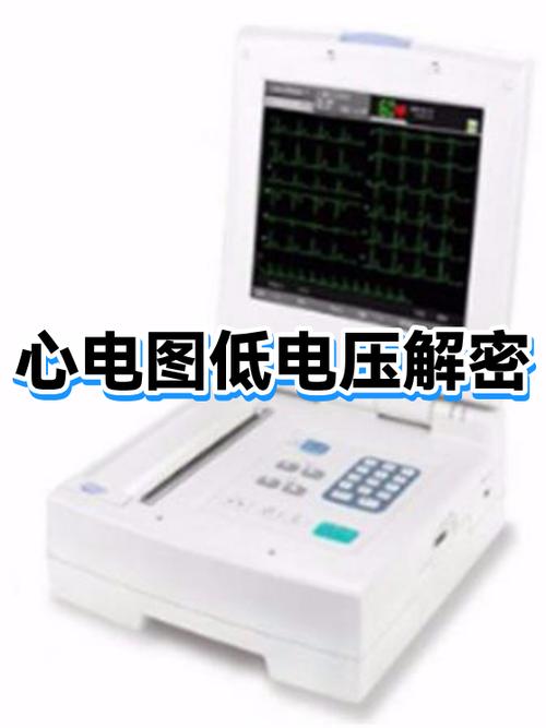 心电图查出低电压是什么意思