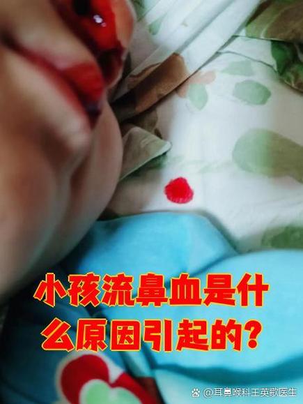 小孩流鼻血什么原因造成的