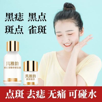 脸部去黑点有什么办法好