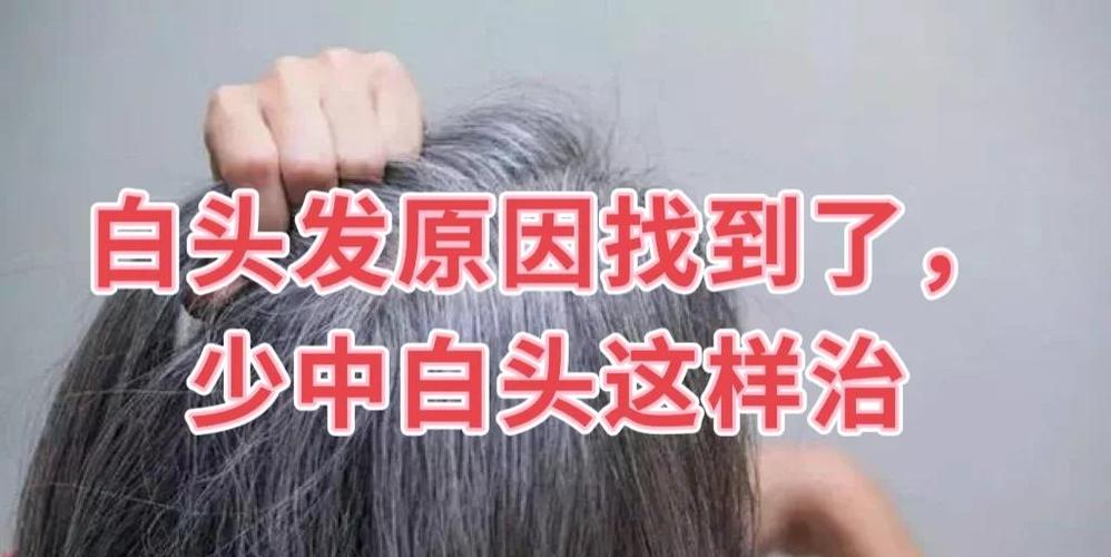 头发白什么原因