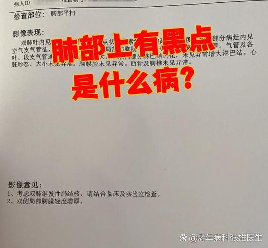 肺部出现黑点阴影
