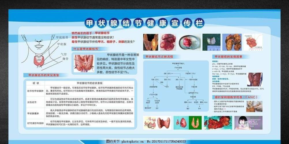 甲状腺可以根治吗缩略图