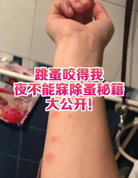 tk挠痒腰和腋窝哪个更怕痒