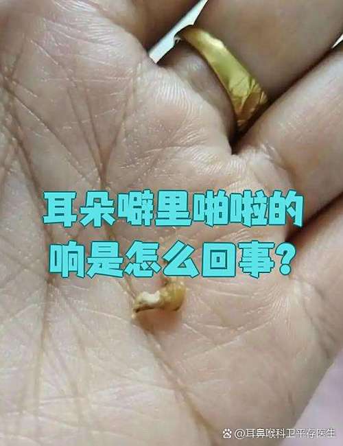 噼里啪啦还是噼哩啪啦的声音