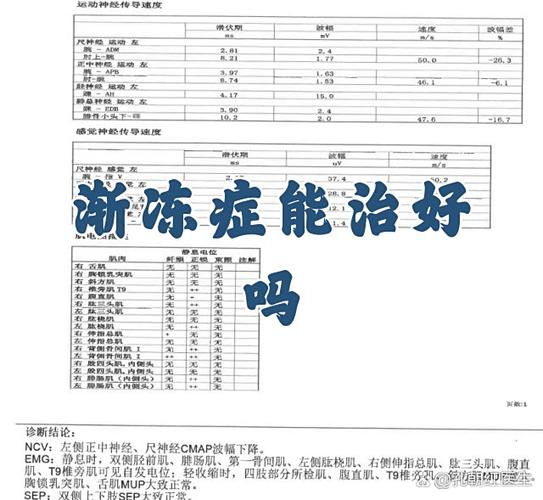 als是渐冻症吗