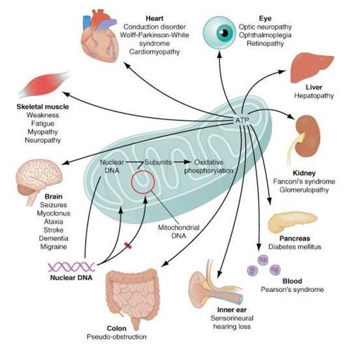 线粒体疾病最新的治疗方法