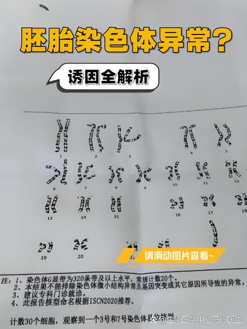 2号染色体重复是什么原因导致的