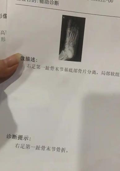 怎么判断小孩摔后没事