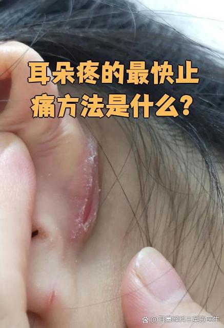 耳朵耗电快的解决方法截图