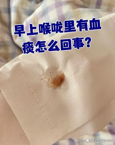 痰中带血不咳嗽是怎么回事