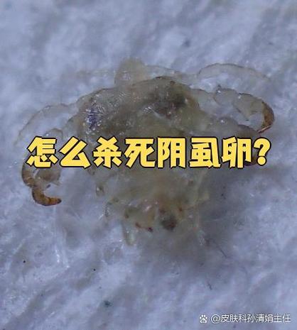 阴虱怎么处理怎么根治