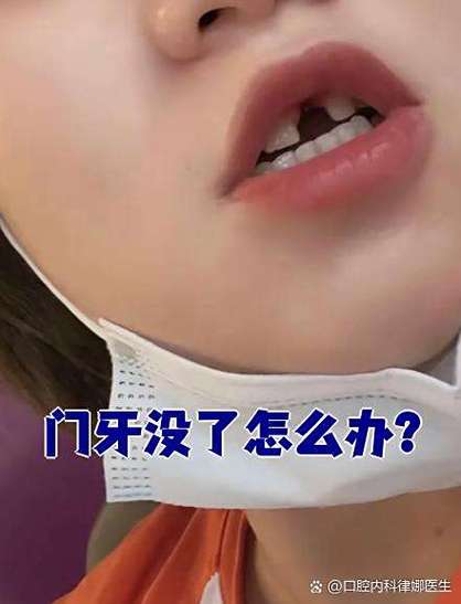 前门牙没有了怎么办