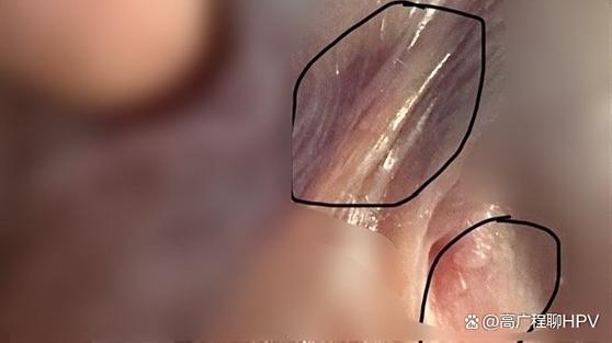 系带的正常样子图片