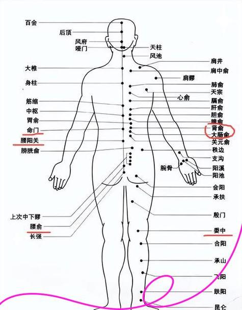 腰部疼痛9位置图游戏截图